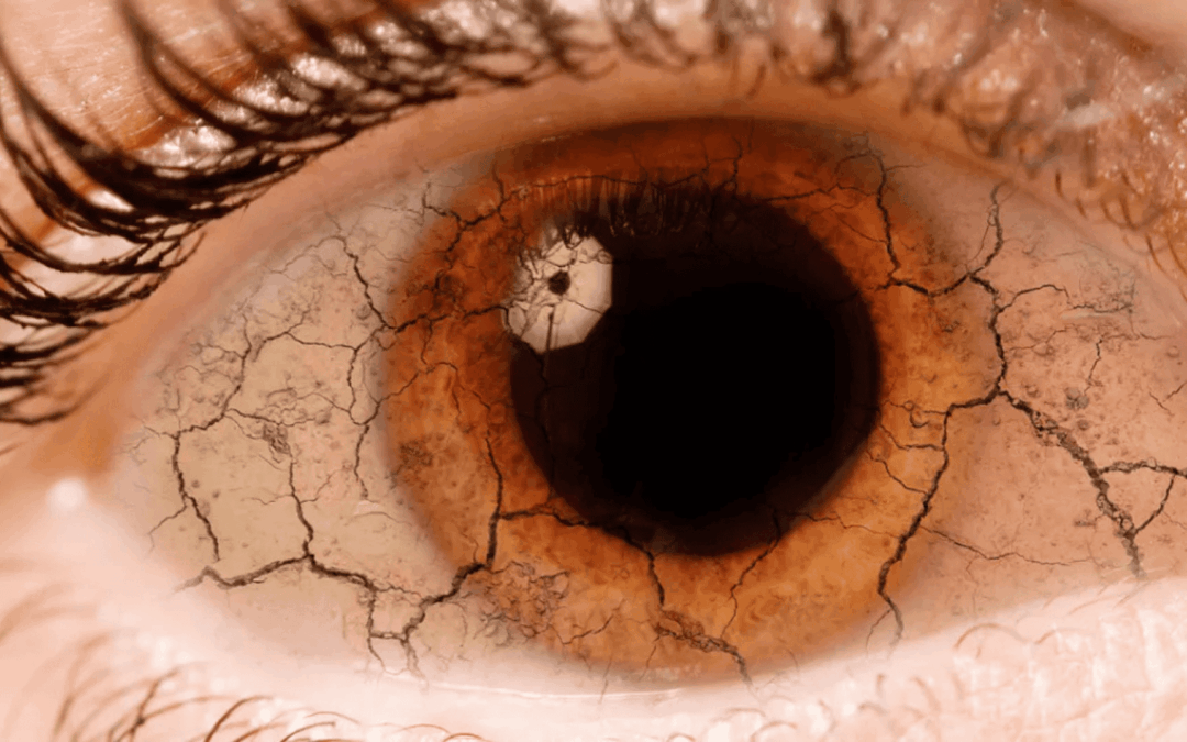 Trockene Augen in den Wechseljahren