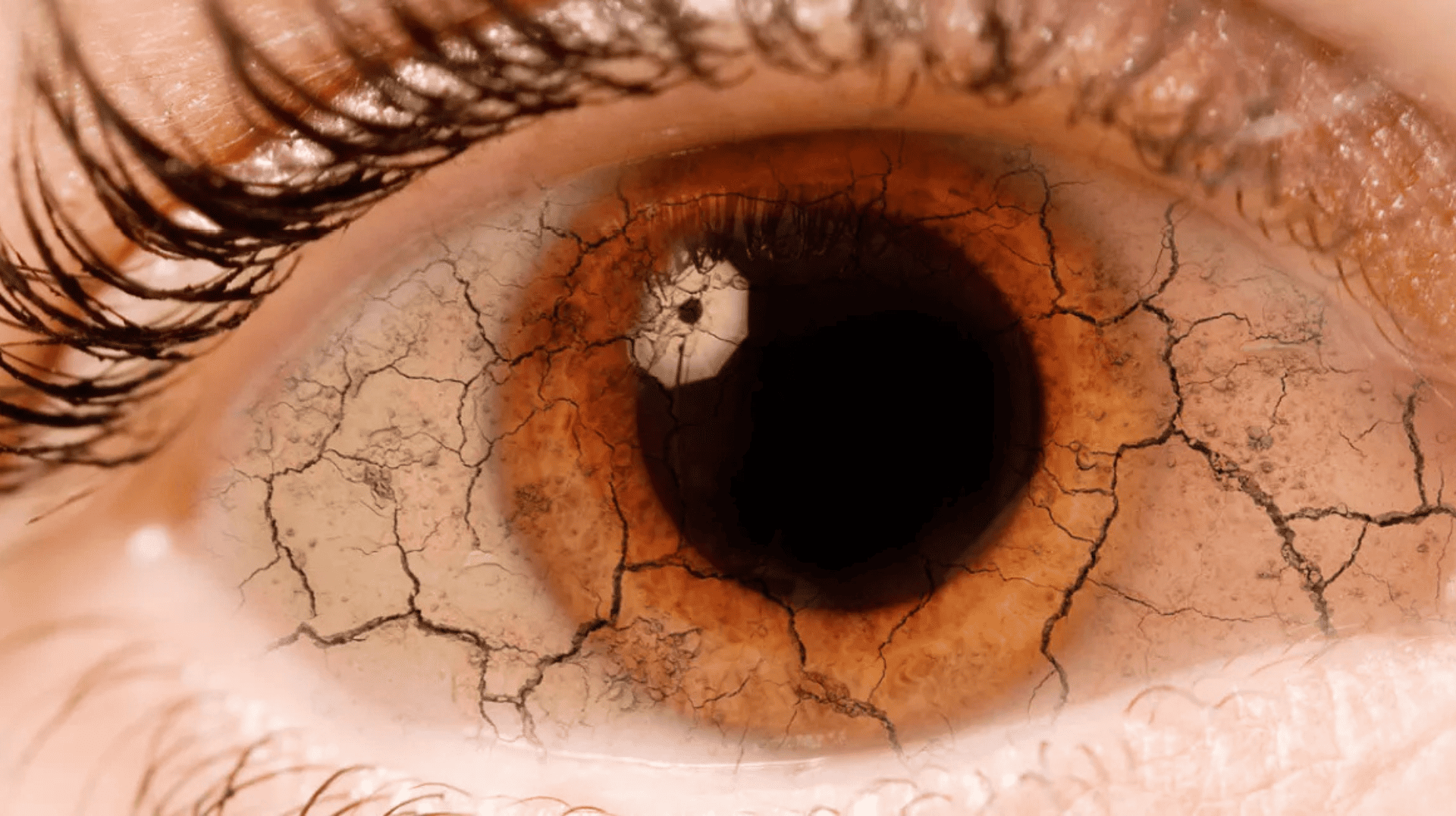 Trockene Augen in den Wechseljahren Makro-Aufnahme eines trockenen Auges